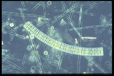 Algal bloom